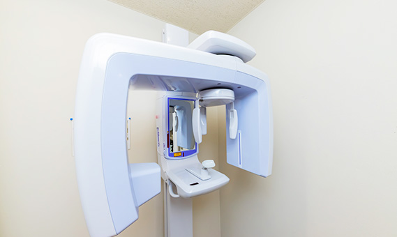 デジタルレントゲン